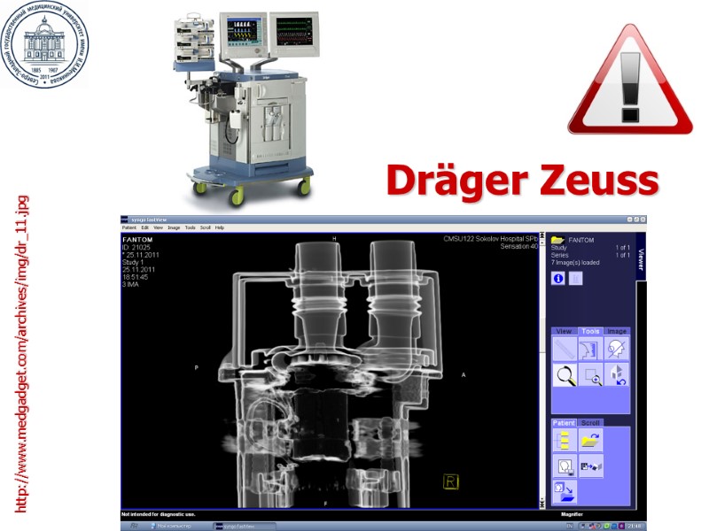 Dräger Zeuss http://www.medgadget.com/archives/img/dr_11.jpg